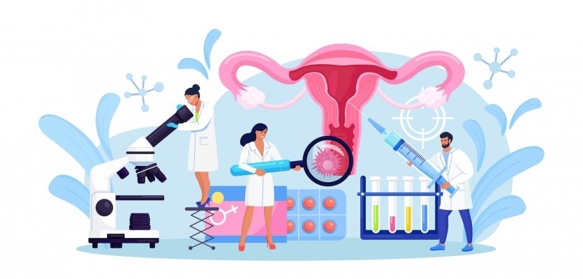 Qu'est-ce que c'est : Le cancer du col de l'utérus ?