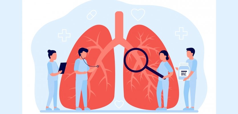Qu'est-ce que c'est : Le cancer du poumon ?