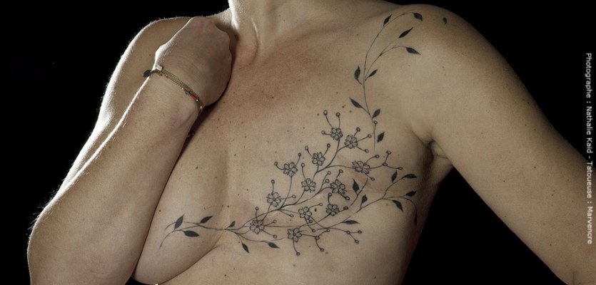 Un tatouage après un cancer du sein ? Un complément ou une alternative à la reconstruction mammaire